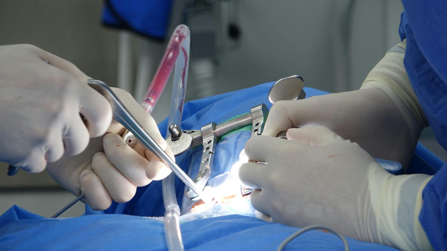 Cervical Disc Fusion Surgery: What to Know