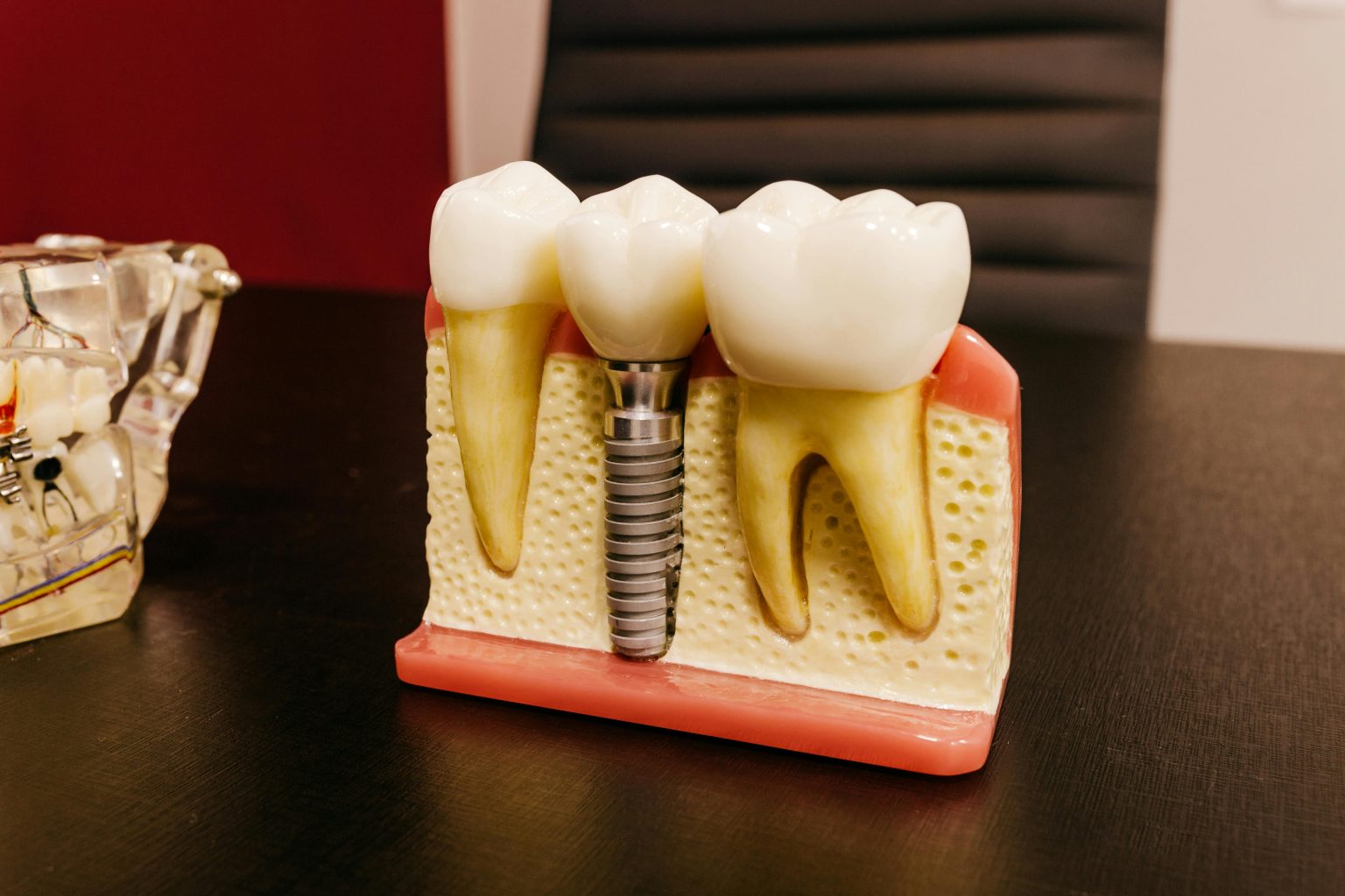 Dental Implant Placement: What to Expect and Why It’s Worth It”