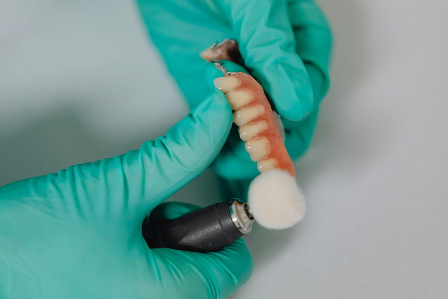 Dental Implants: A Long-Term Solution for Missing Teeth
