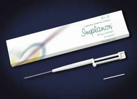 Can You Get Pregnant with a Contraceptive Implant? Understanding Failure Rates